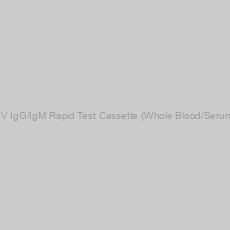 Image of 2019-nCoV IgG/IgM Rapid Test Cassette (Whole Blood/Serum/Plasma)